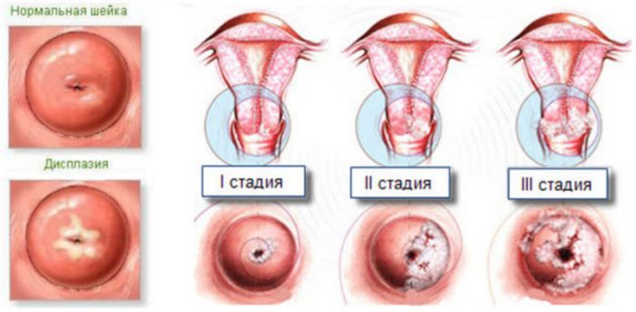 Как выглядит шейка матки