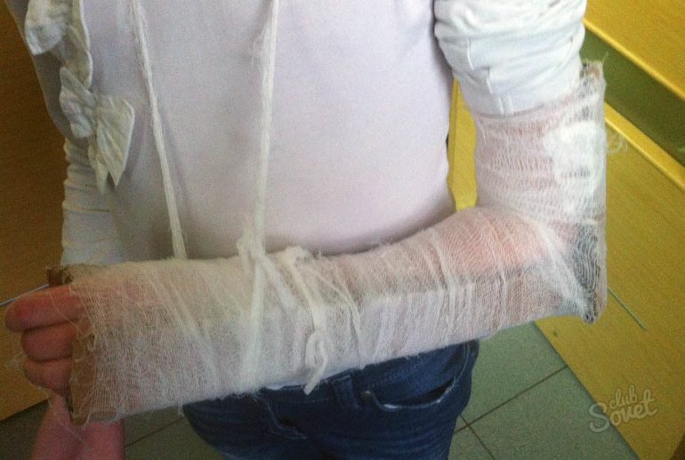 Как сделать гипс в домашних условиях?