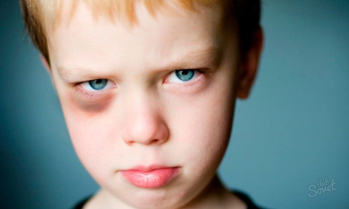 Как замаскировать синяк