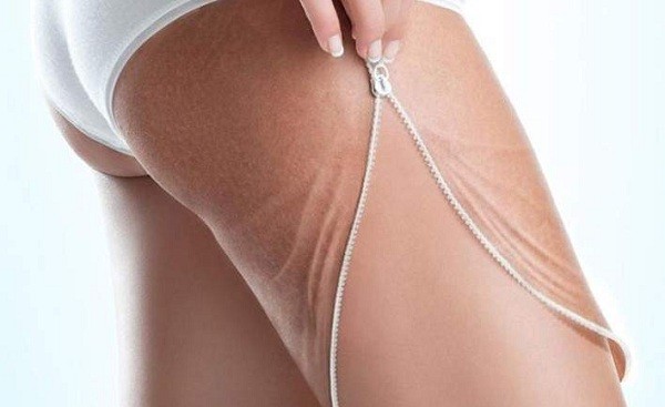 Показання до проведення лімфодренажного масажу Показання до проведення лімфодренажного масажу