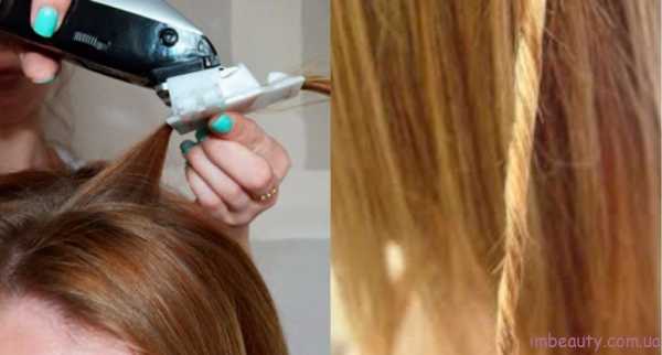 Кому підходить процедура? Кому підходить процедура?