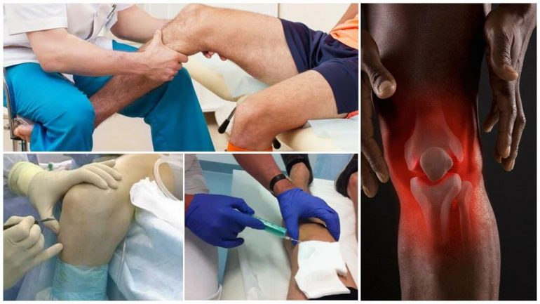 Хірургічне лікування Хірургічне лікування