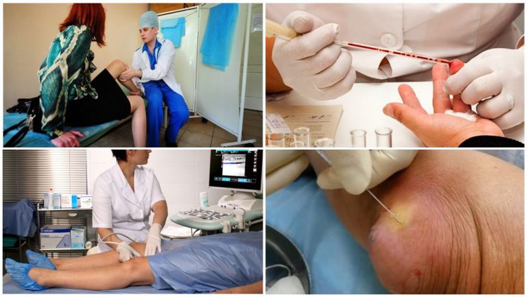 Діагностика бурситу Діагностика бурситу