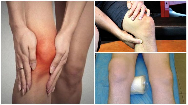 Клінічні прояви Клінічні прояви