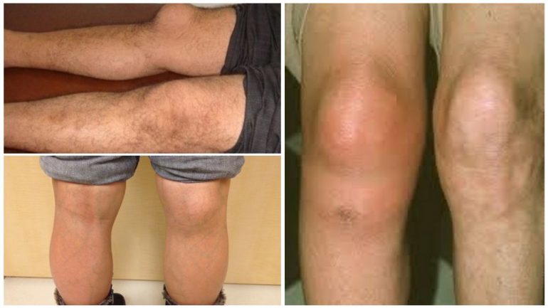 Види захворювання Види захворювання