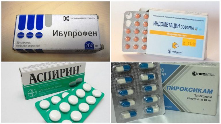 Медикаментозне лікування бурситу Медикаментозне лікування бурситу