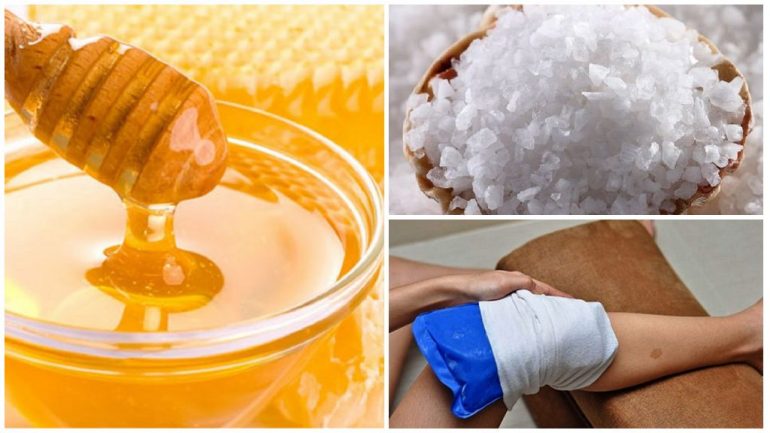 Народні засоби Народні засоби