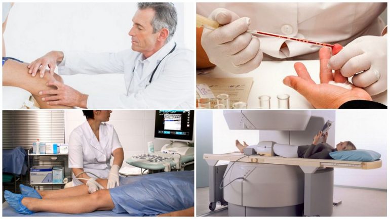 Діагностика бурситу Діагностика бурситу