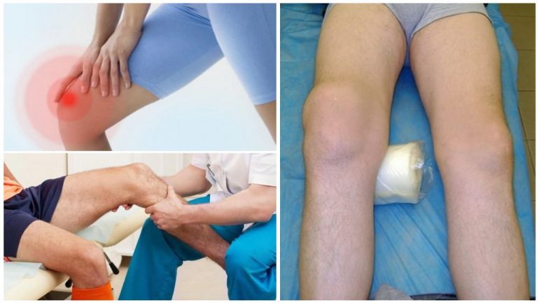 Як проявляється Як проявляється