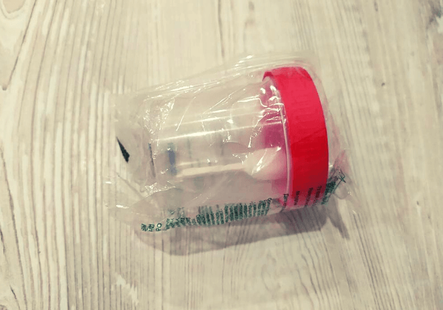 Як зібрати сечу у новонародженого дівчинки, хлопчика, однорічної дитини, в баночку для аналізу, загальний збір через мочеприймальник