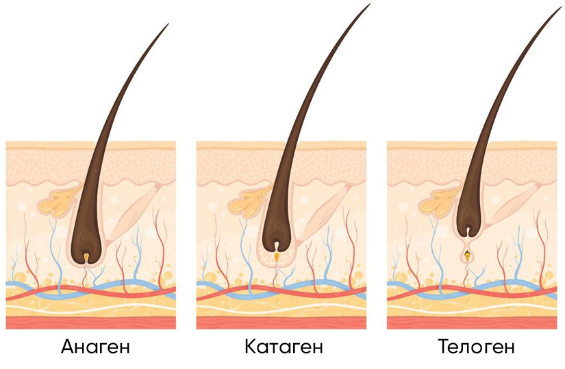 Чи можна видалити волосся назавжди і який вид епіляції краще вибрати – лазер, IPL чи ELOS