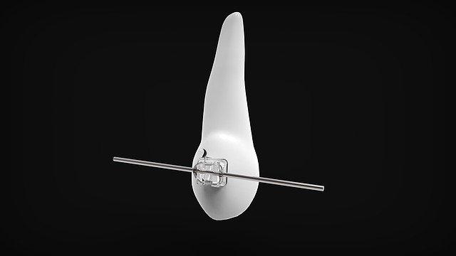 Які найкращі брекети?