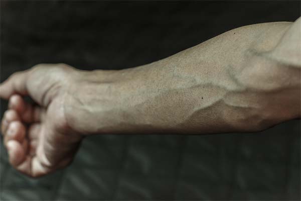 До чого сняться вени на руках чи ногах — 33 тлумачення з різних сонників