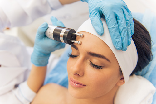 Радиолифтинг