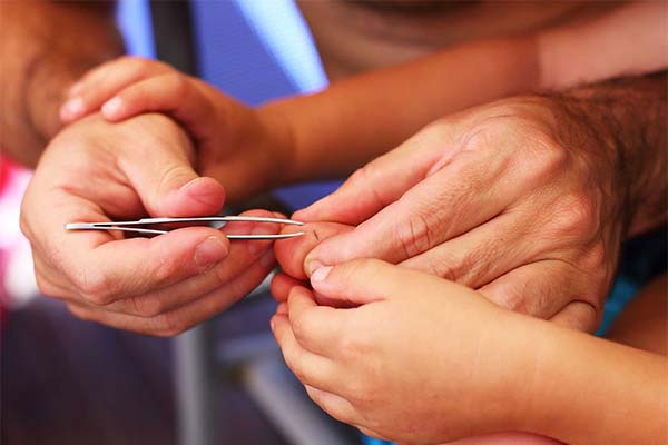 До чого сниться скалка в руці чи нозі — 48 тлумачень із різних сонників.