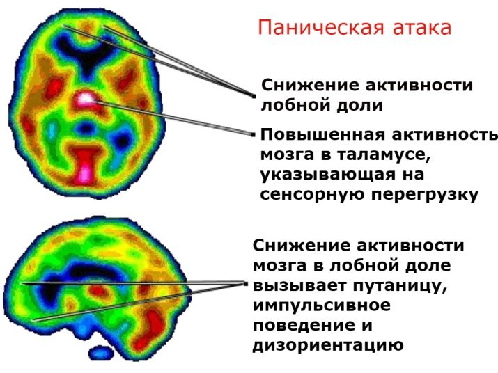 Страх: що це таке, користь та шкода, причини та способи боротьби