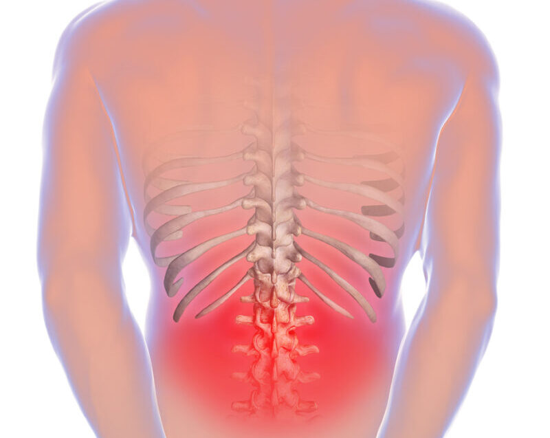 Міжхребцева грижа