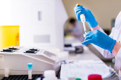 Аналіз ТТГ: коли варто перевірити рівень тиреотропного гормону